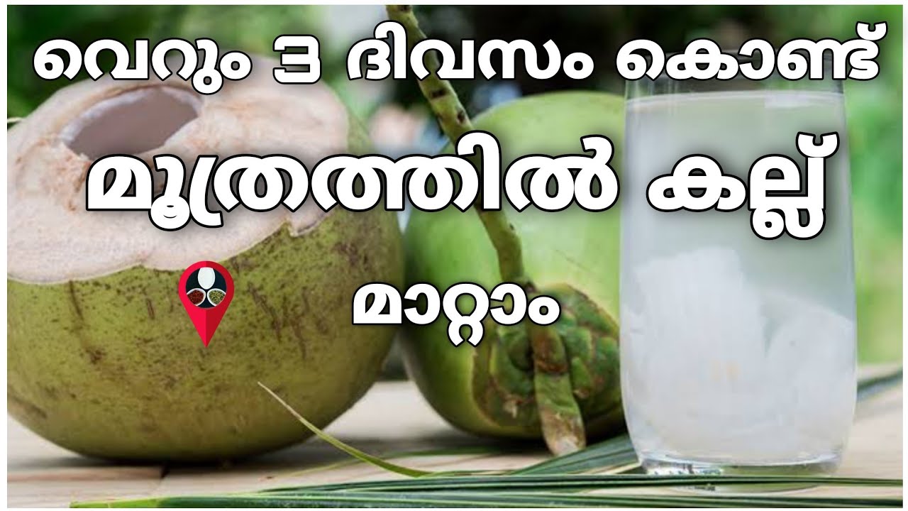 മൂത്രത്തിൽ കല്ല് മാറ്റിയെടുക്കാൻ ഇത് മാത്രം ചെയ്താൽ മതി