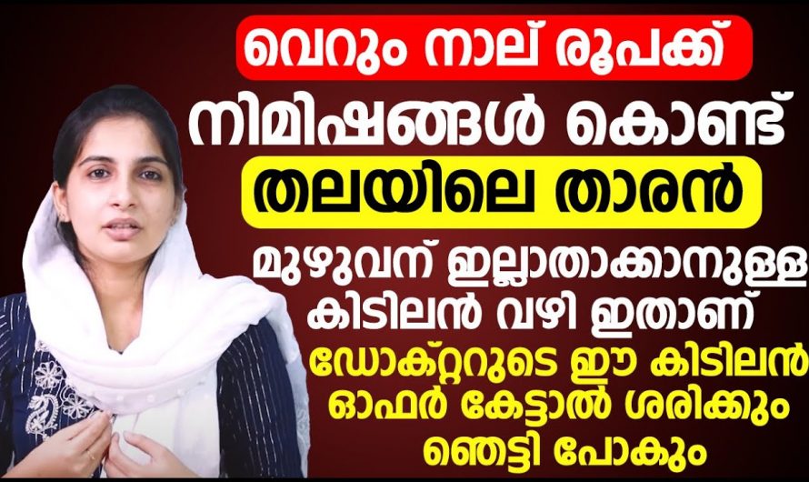 നിങ്ങളും താരൻ കൊണ്ട് ബുദ്ധിമുട്ടുന്നവരാണോ, പുറ്റ് പോലും അവശേഷിക്കാതെ താരനില്ലാതാകും.