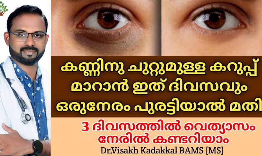 കണ്ണിന് ചുറ്റുമുള്ള കറുപ്പ് നിറം മാറ്റാൻ ഇനി മൂന്ന് എളുപ്പമാർഗങ്ങൾ.