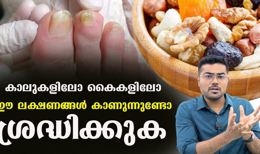 നിങ്ങളുടെ കൈകാലുകളിൽ ഈ ലക്ഷണങ്ങൾ കാണുന്നുണ്ടോ.