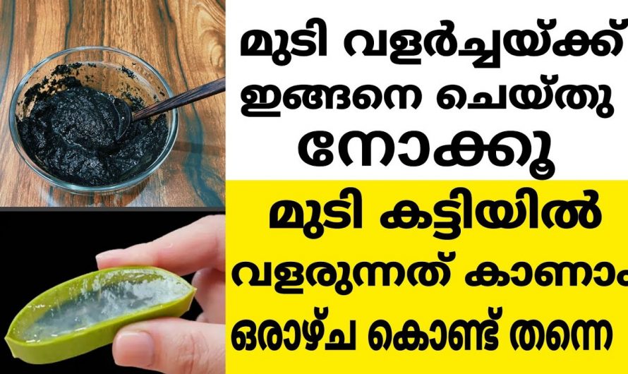 ഇനി ആർക്കും കട്ടിയുള്ള കറുത്ത മുടിയിഴകൾ സ്വന്തം . ഒരു കറ്റാർവാഴ പ്രയോഗം.