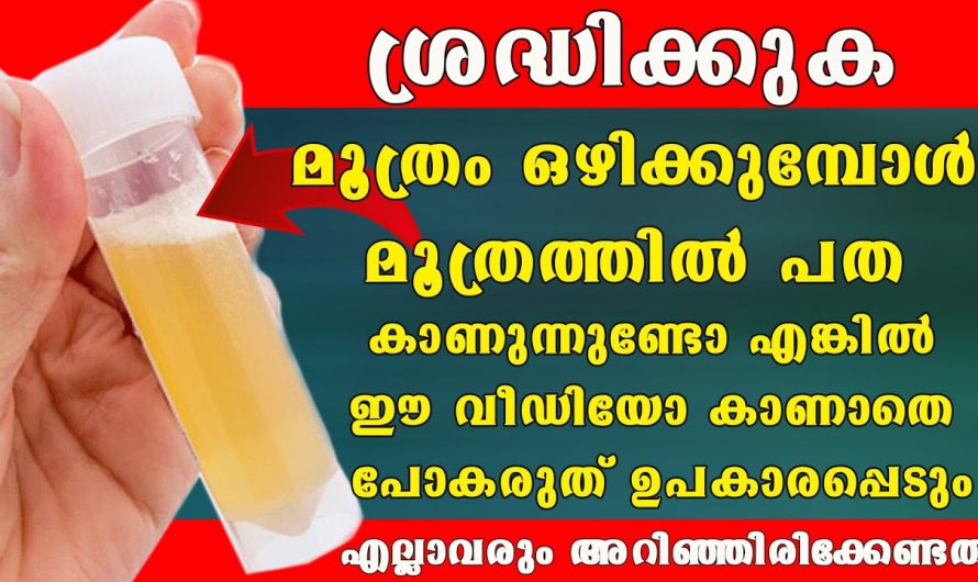 നിങ്ങളുടെ മൂത്രത്തിൽ പത കാണുന്നുണ്ടോ, നിങ്ങൾ മൂത്രമൊഴിക്കുമ്പോൾ ഇങ്ങനെയാണോ കാണുന്നത്, സൂക്ഷിക്കണം.