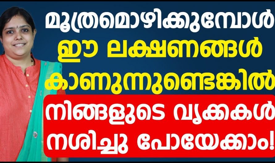 നിങ്ങൾ മൂത്രമൊഴിക്കുമ്പോൾ എങ്ങനെയാണ് പോകുന്നത്. മൂത്രത്തിൽ ഇങ്ങനെ കാണുന്നുണ്ടോ.