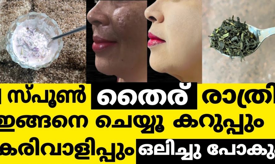 എത്ര കറുത്ത പാടുകളും മാറുന്നതിന് തൈര് ഇങ്ങനെ ഉപയോഗിക്കു.