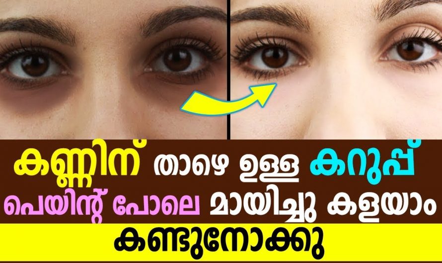 കണ്ണിനടിയിലെ കറുപ്പും ചുളിവും ഇനി നിസ്സാരമായി മാറ്റാം