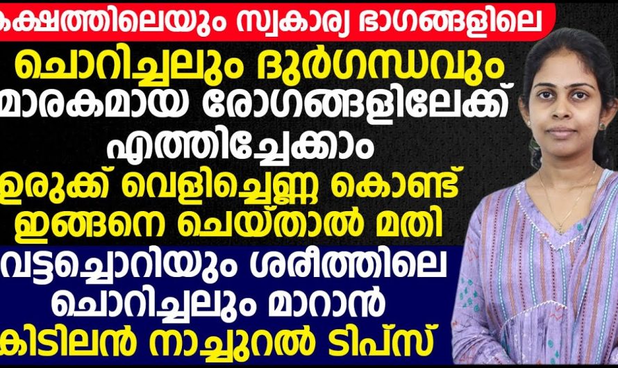 ഗുഹ്യഭാഗങ്ങളിലെ ചൊറിച്ചിലും ദുർഗന്ധവും ഇനി അല്പം വെളിച്ചെണ്ണ കൊണ്ട് പരിഹരിക്കാം.