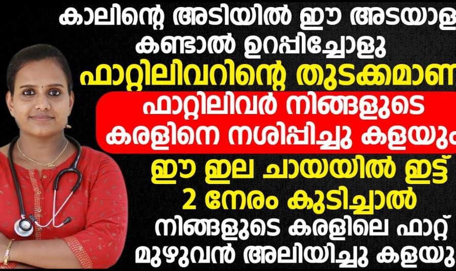 നിങ്ങളുടെ ശരീരത്തിൽ ഈ ലക്ഷണം കാണുന്നുണ്ട് എങ്കിൽ ഫാറ്റി ലിവർ ആണെന്ന് സംശയിക്കാം.