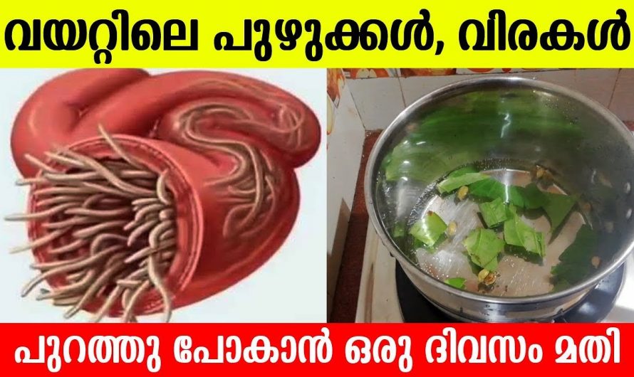 വയറിനകത്തുള്ള വിരമുഴുവൻ ഭയന്നോടും, ഇതൊരു ഗ്ലാസ് കുടിച്ചാൽ മതി.