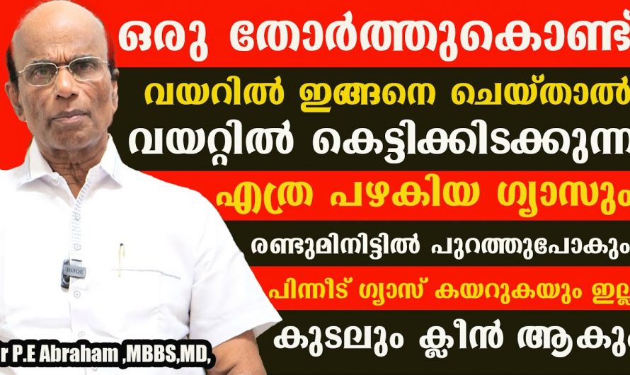 നനഞ്ഞ ഒരു തോർത്ത് മതി നിങ്ങളുടെ നീർക്കെട്ട് മാറ്റാൻ. നിങ്ങൾക്ക് അസിഡിറ്റി പ്രശ്നങ്ങൾ ഉണ്ടോ എങ്കിൽ ഇതൊന്നു പരീക്ഷിക്കൂ.