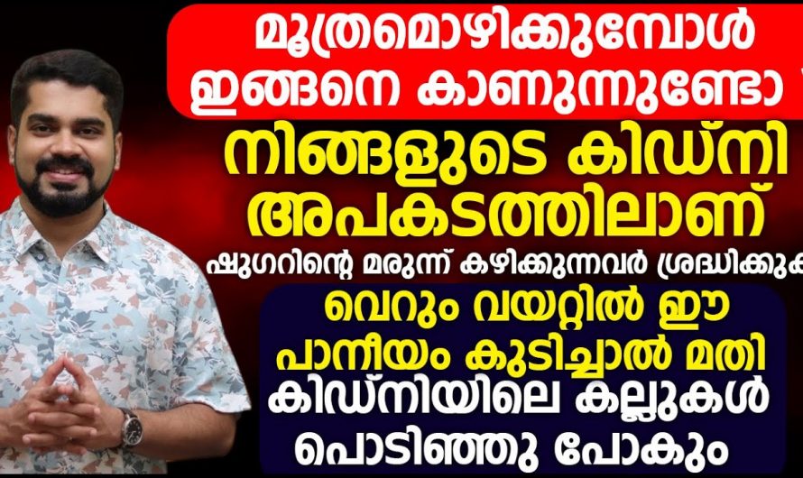 കിഡ്നിയിൽ കല്ലുകൾ ഉണ്ടോ, ഈ ലക്ഷണങ്ങൾ കണ്ടാൽ നിസാരമാക്കരുത്.