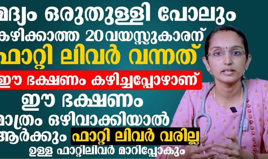 ഒരു തുള്ളി മദ്യം വേണ്ട ഫാറ്റി ലിവർ നിങ്ങൾക്കും വരാം. ഈ ഭക്ഷണം മാത്രം ഒഴിവാക്കു.