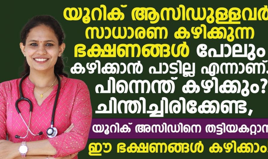 യൂറിക് ആസിഡ് രോഗികൾക്ക് ഇനി ഒരു ശാശ്വത പരിഹാരം. നിങ്ങൾക്കും ഇനി ആശ്വസിക്കാം.