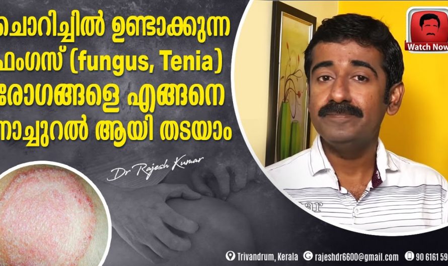 ആർത്തവ ശേഷം സ്ത്രീകളിൽ കാണുന്ന ഇത്തരം ചൊറിച്ചിലുകൾ വളരെ പെട്ടെന്ന് ഇല്ലാതാക്കാം.