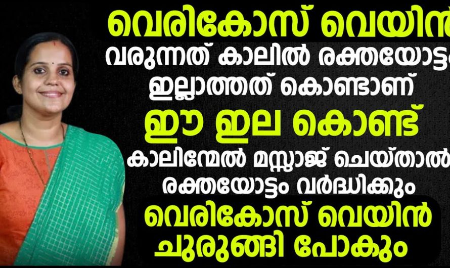 നിങ്ങൾക്കും വെരിക്കോസ് പ്രശ്നങ്ങൾ ഉണ്ടോ ഈ ഇല ഒരെണ്ണം കിട്ടിയാൽ പിന്നെയെല്ലാം എളുപ്പമാണ്