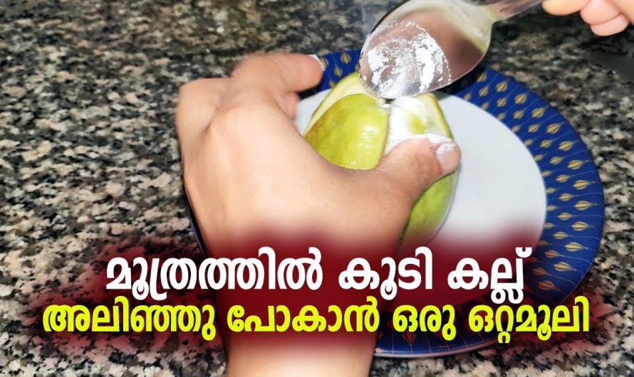 മൂത്രത്തിലെ കല്ല് ഇനി അത് എത്ര വലുതാണെങ്കിലും ഒരാഴ്ച കൊണ്ട് മാറിക്കിട്ടും