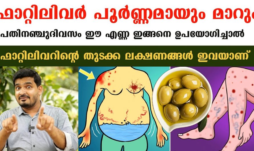 ഇനി വെറും ഒരു മാസം കൊണ്ട് ഫാറ്റി ലിവർ മാറ്റിയെടുക്കാം