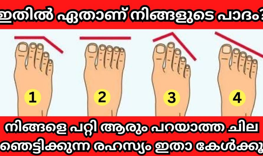 നിങ്ങളുടെ കാൽപാദവും ഈ രീതിയിലാണെങ്കിൽ രക്ഷപ്പെട്ടു എന്ന് പറയാം