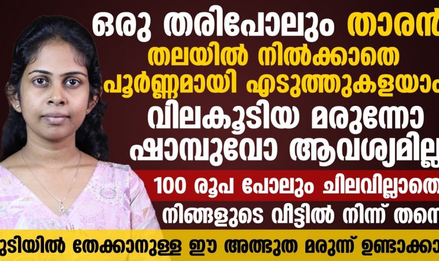 ഇടയ്ക്കിടെ ഉണ്ടാകുന്ന താരൻ പ്രശ്നങ്ങൾക്ക് ഇനി പരിഹാരം ഇങ്ങനെ