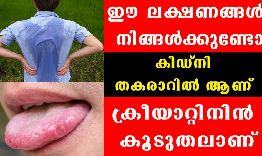 നിസ്സാരമാക്കേണ്ട ഈ ലക്ഷണങ്ങൾ നിങ്ങളുടെ മരണത്തിന്റെ സൂചനയാണ്