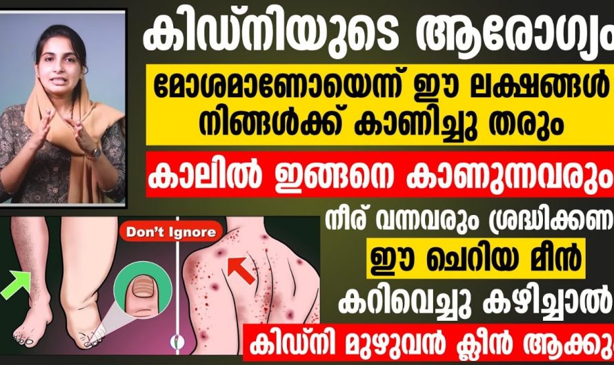 കിഡ്നി സംരക്ഷണത്തിനും നിങ്ങളുടെ ജീവൻ നിലനിൽപ്പിനും ഈ കാര്യങ്ങൾ ശ്രദ്ധിക്കുക