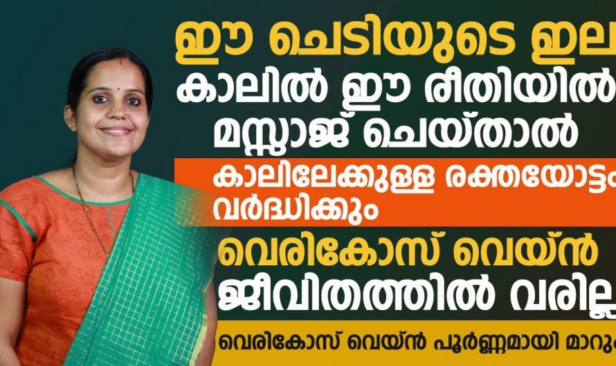 നിങ്ങളുടെ കാലുകളിലും ഞരമ്പുകൾ ഇങ്ങനെ തടിച്ചു വീർക്കുന്നുണ്ടോ