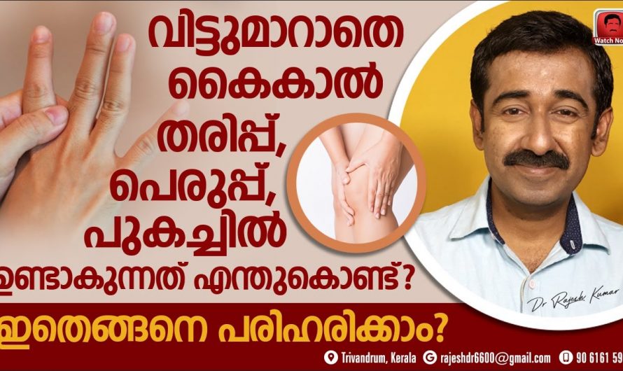 നിങ്ങളുടെ കൈകാലുകളിലും ഇങ്ങനെ ചൊറിച്ചിലും പുകച്ചിലും എരിച്ചിലും അനുഭവപ്പെടുന്നുണ്ടോ