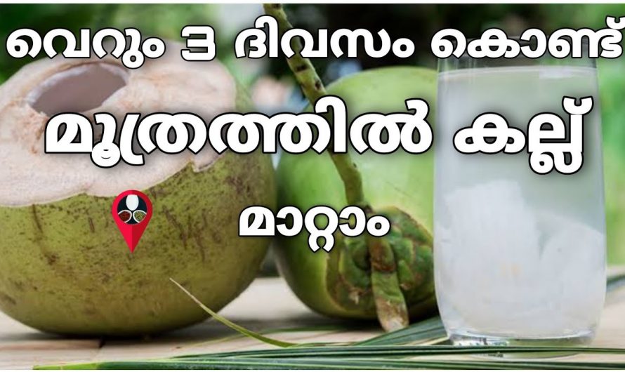 3 ദിവസം കൊണ്ട് എത്ര വലിയ മൂത്രക്കല്ലം കൊഴിഞ്ഞു പോകും