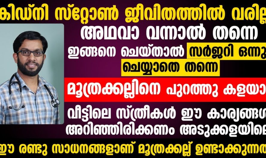 കിഡ്നി സ്റ്റോൺ ഉള്ളവർ ഉറപ്പായും ഇതറിഞ്ഞാൽ സന്തോഷിക്കും