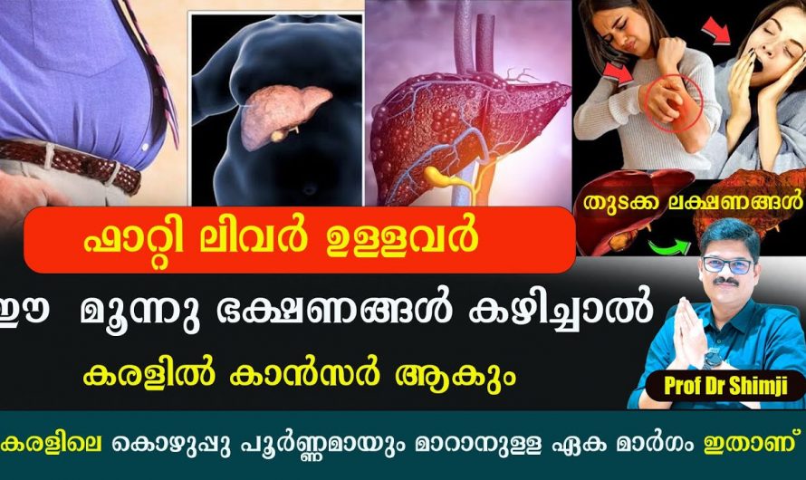 കരളിനെ കൊലപ്പെടുത്തുന്ന ഈ അവസ്ഥ നിങ്ങളിലും ഉണ്ടാകാം