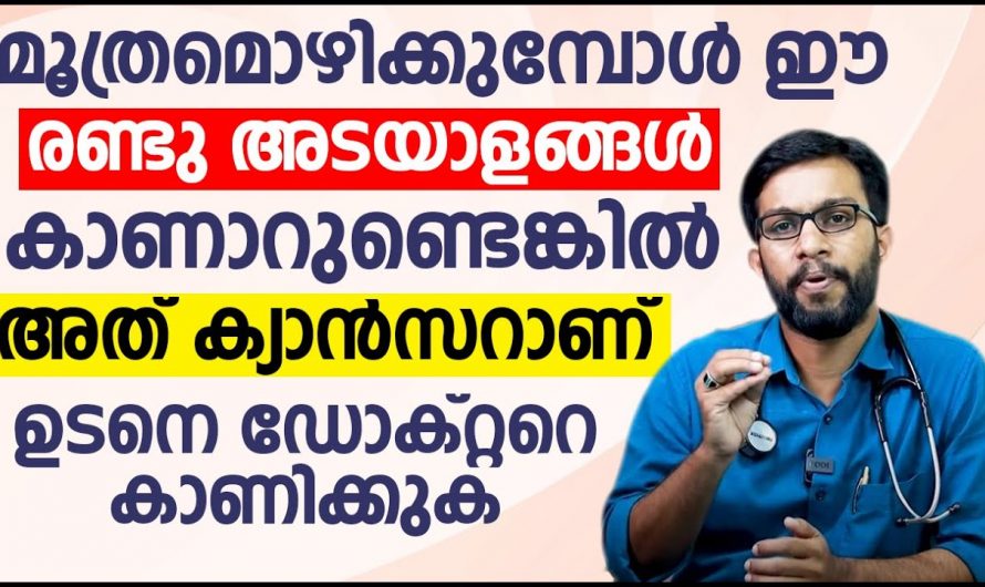 ശരീരത്തിലെ ഈ ലക്ഷണങ്ങൾ നിസ്സാരമാക്കണ്ട. 50 ശതമാനം ആളുകളുടെയും ജീവനെടുക്കും ഈ രോഗം