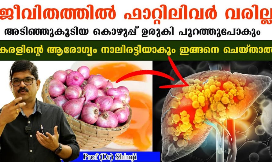 ഫാറ്റി ലിവർ ഉള്ളവർ നിർബന്ധമായും ചെയ്തിരിക്കേണ്ട കാര്യം